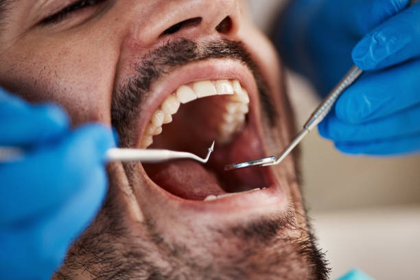 Best Emergency Dental Services for Seniors in Sultana, CA