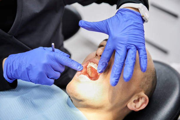 Best Emergency Dentist for Knocked-Out Tooth in Sultana, CA